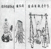 Illustrations from Golden Mirror of Medicine about bone setting